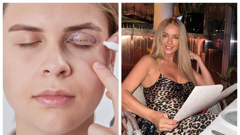 Ce este Blefaroplastia — intervenția estetică în vogă pentru ochi mai odihniți